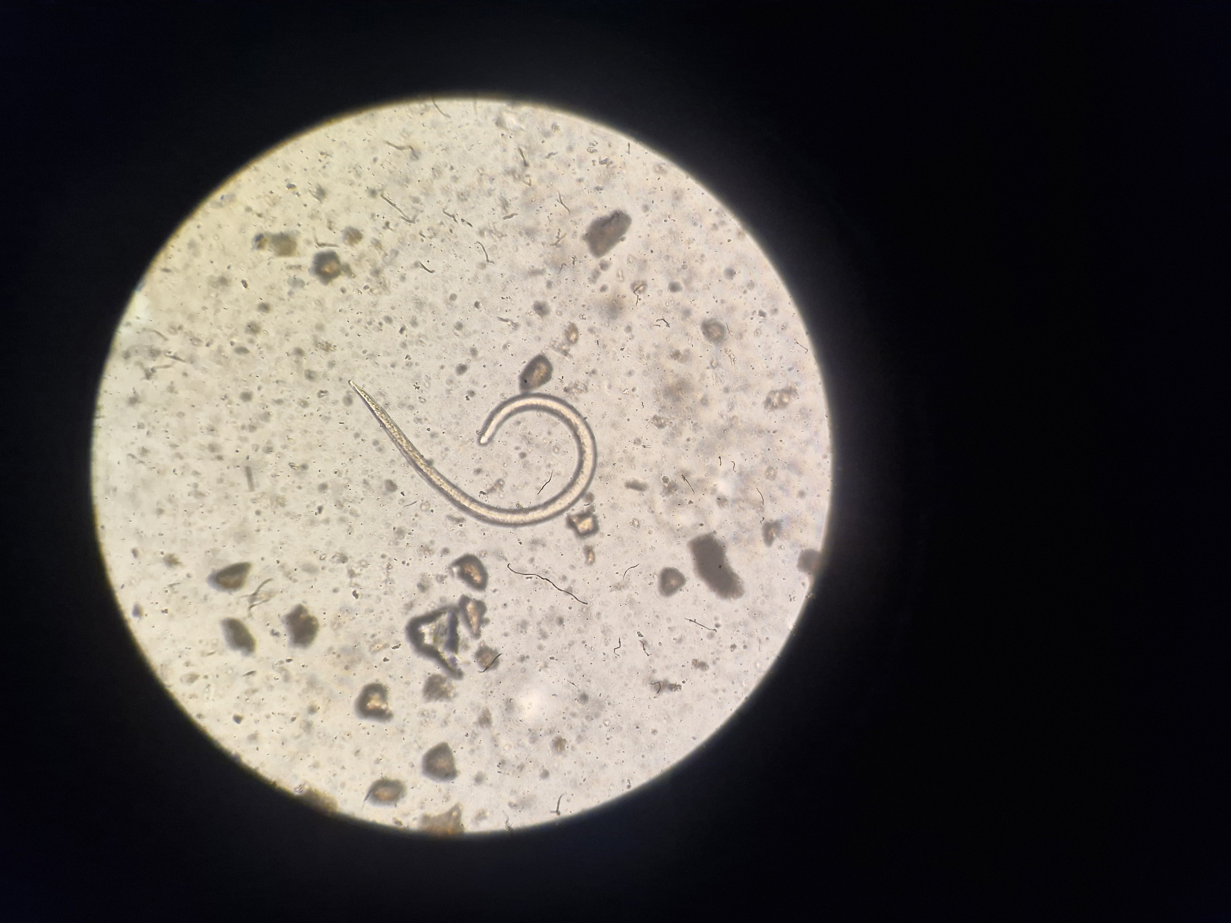 Detectan larvas de triquinosis en chacinados provenientes de una carnicería de Lincoln
