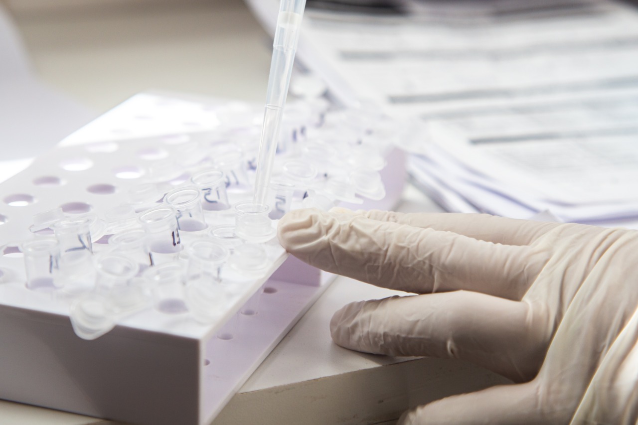 En la última semana, el laboratorio del Hospital Municipal procesó más de 240 muestras